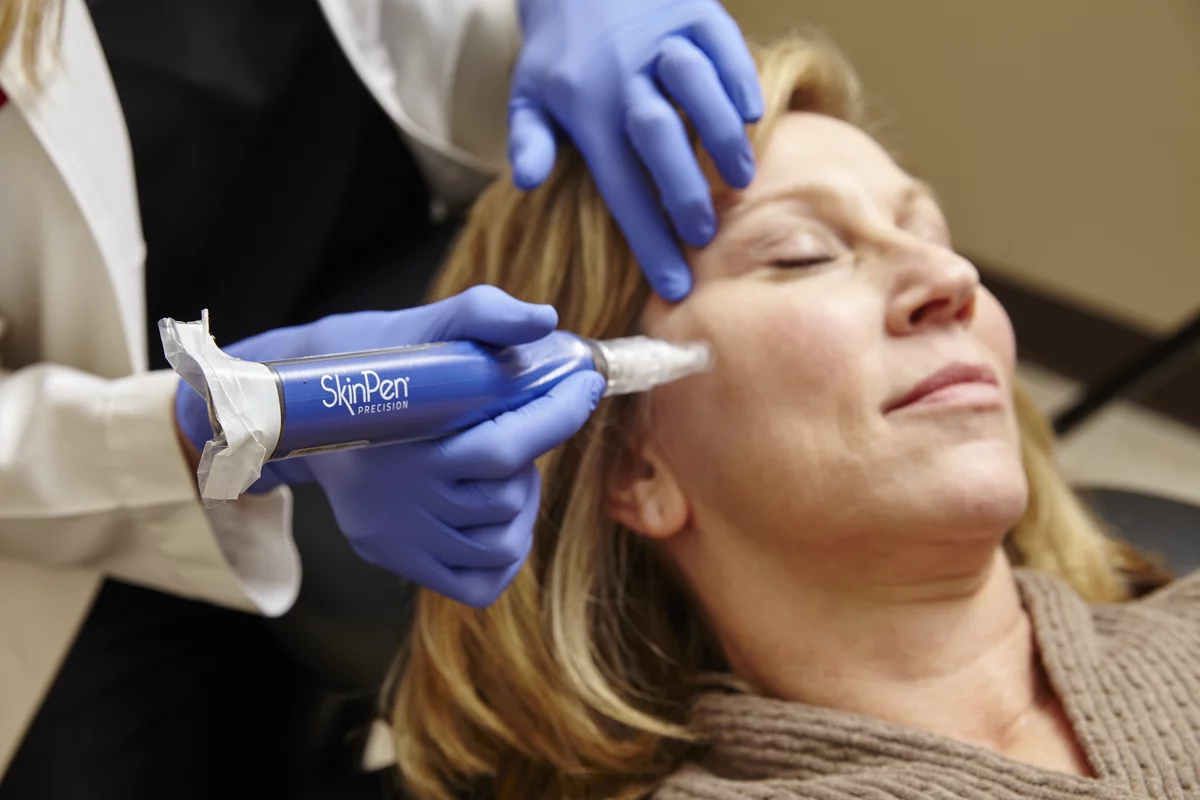 SkinPen Precision Behandlung im Feel Beautiful by Nicole